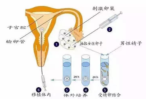 試管嬰兒有配錯(cuò)的嗎？試管嬰兒有不利的一面嗎？